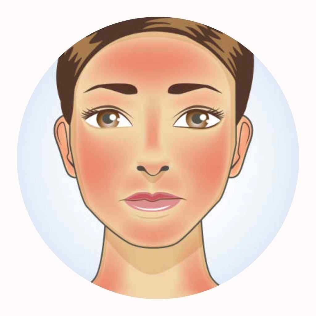 skin concerns Redness