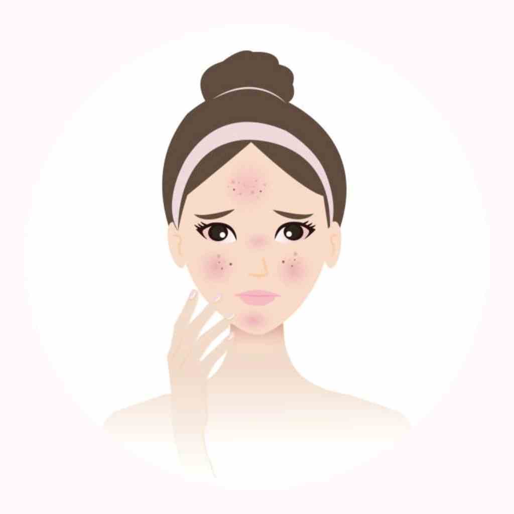 skin concerns dehydration