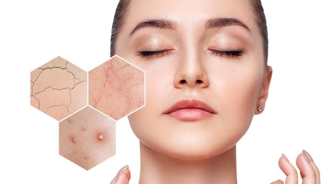 Skincare Routine for Sensitive Skin: Complete Guide to Calm, Protect, and Nourish Your Skin