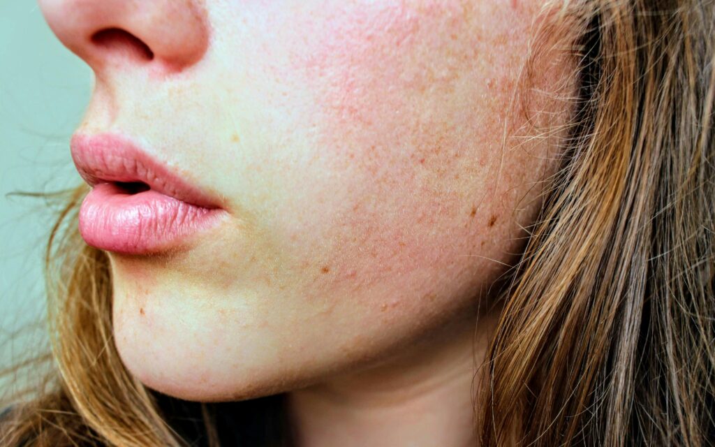 skincare routine for dry skin